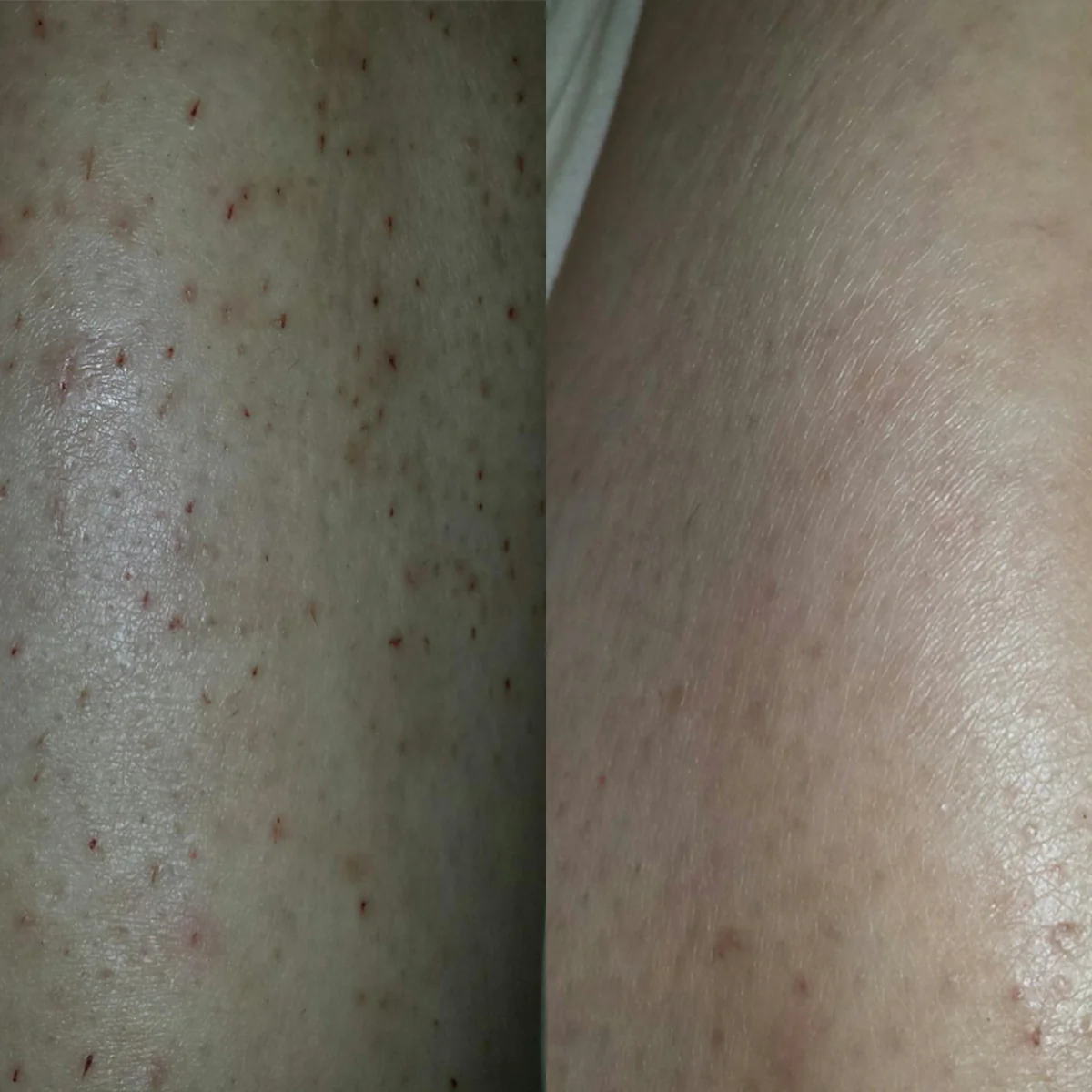 Gly + Sal Exfoliating Body Lotion - Image 10