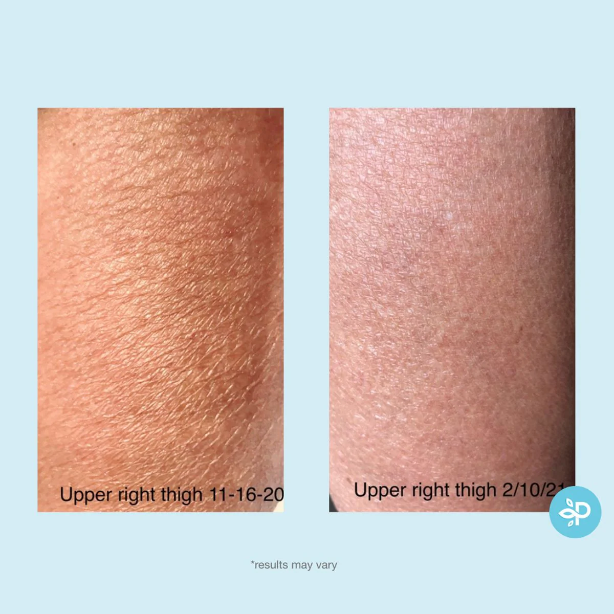 Gly + Sal Exfoliating Body Lotion - Image 11