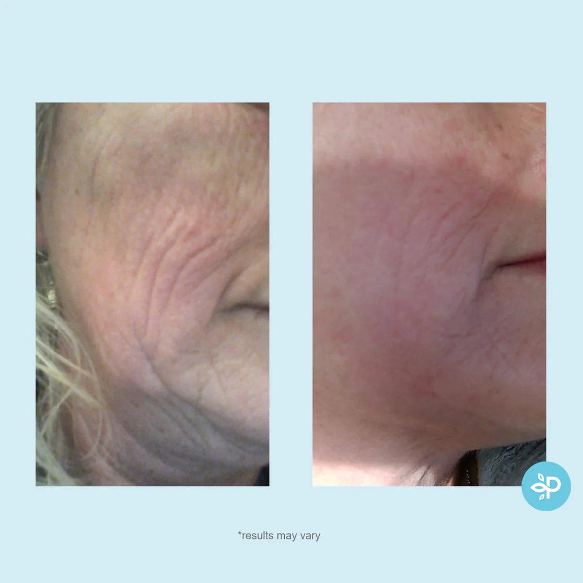 Hydra-Repair Wrinkle Cream - Image 4