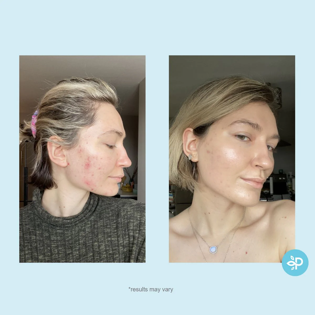 Hydro-Glo Peel Pads 10% - Image 4