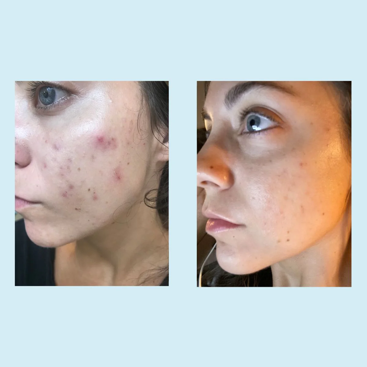 Salicylic Deep Gel Cleanser - Image 4
