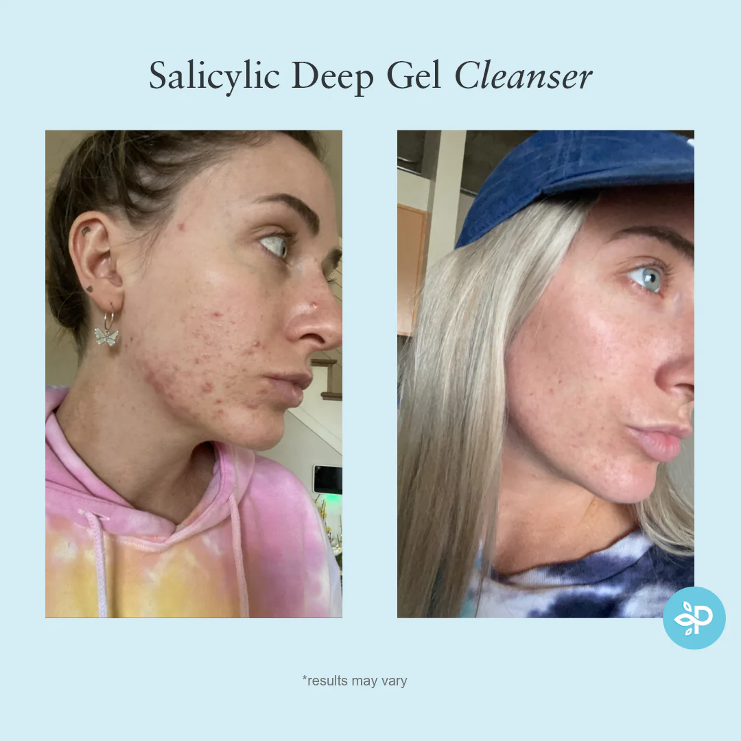 Salicylic Deep Gel Cleanser - Image 9